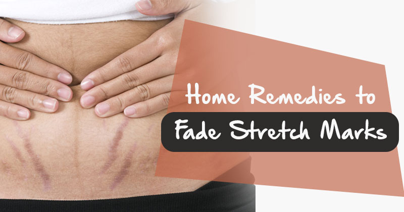stretch marks cover english