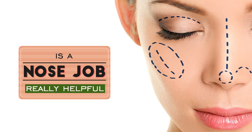 _397_nose job