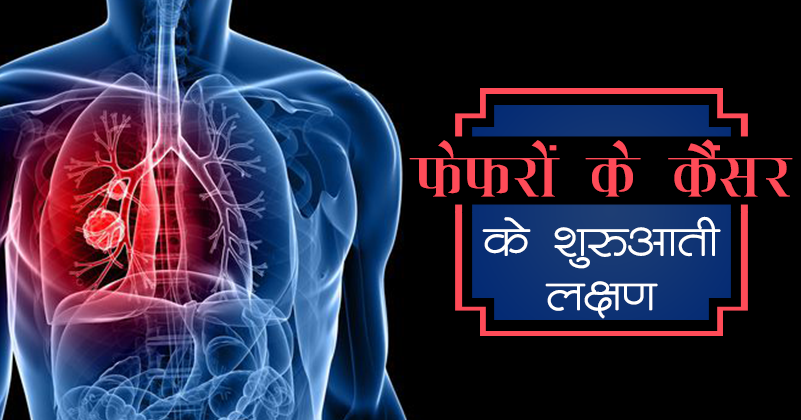 _442_फेफरों के कैंसर