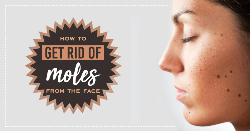 _445_get rid of moles