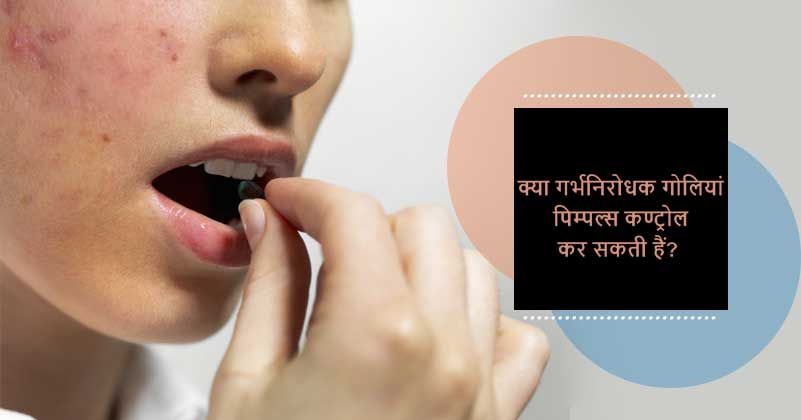 Can Birth Control Pills Cure Aacne