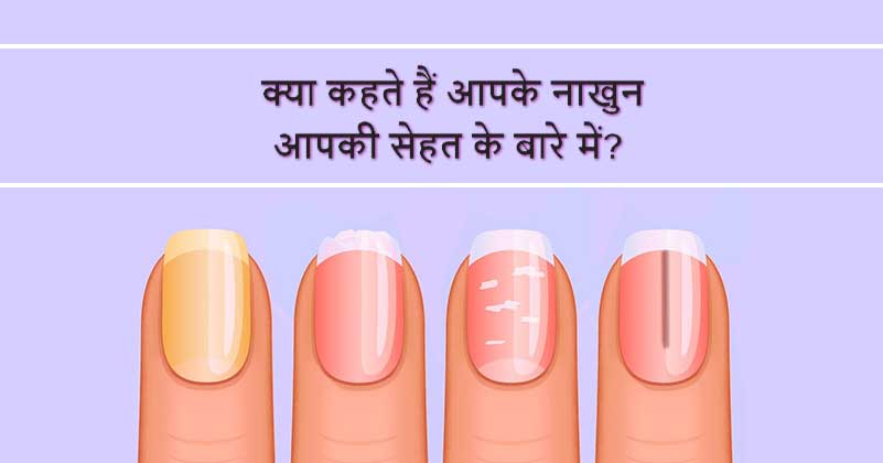 Signs of illness Nails