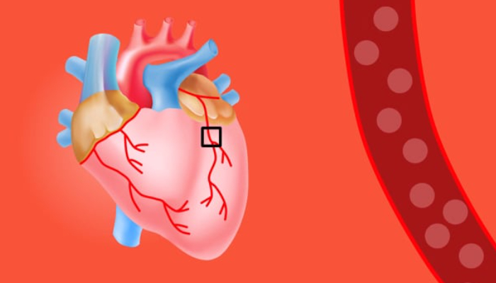 Beetroot For Heart Disease