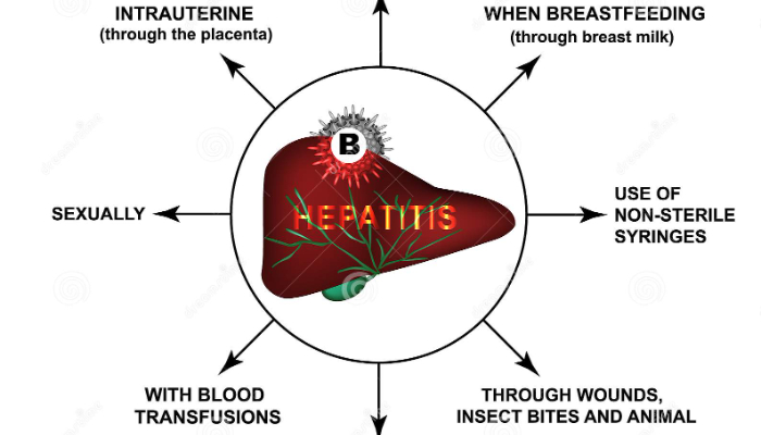 Causes Of Hepatitis