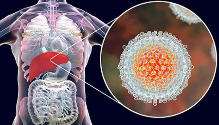What Is Hepatitis