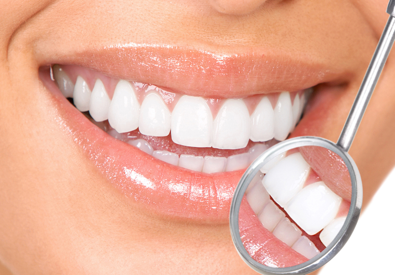 teeth whitening is a popular option